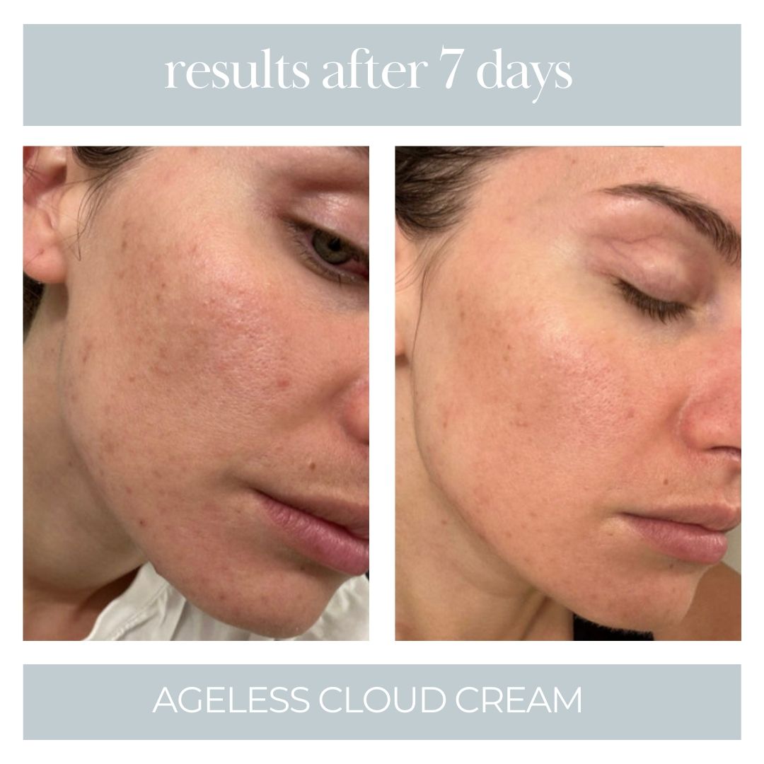 Ageless Cloud Cream